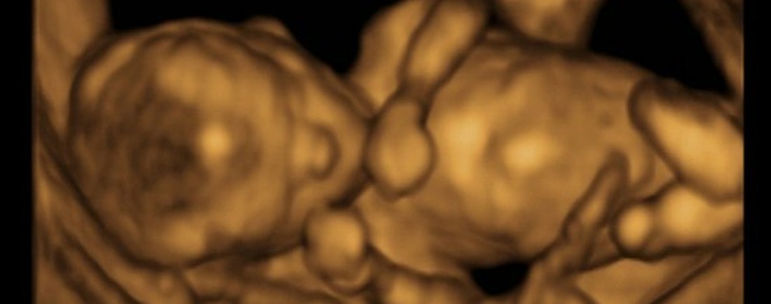 ultrazvukový snímek